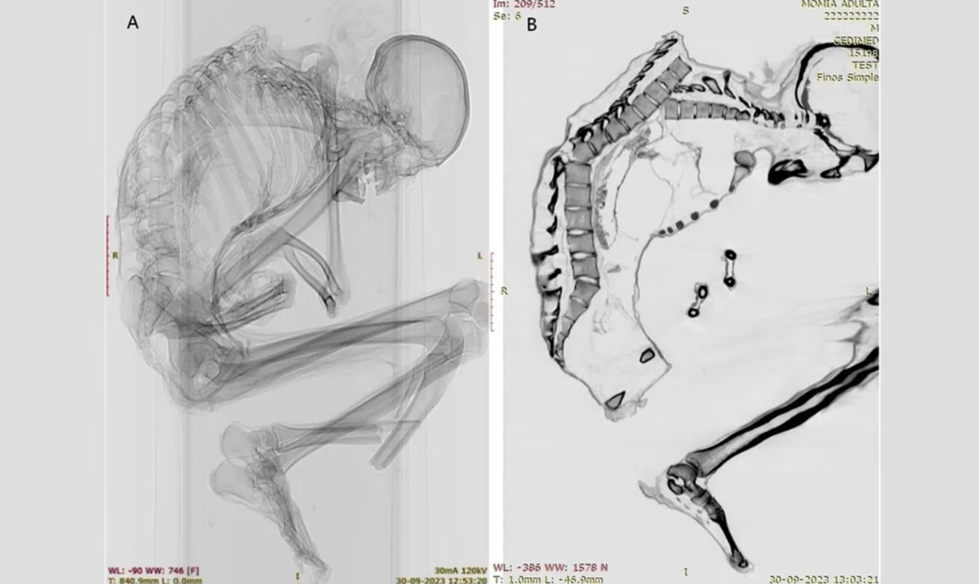 Misteri Terpecahkan Setelah 1.100 Tahun: Mumi Atacama Tewas Akibat Kecelakaan Tambang Prasejarah